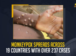 Monkeypox Spreads Across 19 Countries With Over 237 Cases, Monkeypox Spreads Across 19 Countries, 237 Cases Of Monkeypox In 19 Countries, outbreak of monkeypox cases outside of Africa can be contained, World Health Organization, 237 suspected and confirmed cases of the Monkeypox in 19 countries, Monkeypox is a usually mild viral infection that is endemic in parts of the west and central Africa, Monkeypox In 19 Countries, 19 Countries, Monkeypox News, Monkeypox Latest News, Monkeypox Latest Updates, Monkeypox Live Updates, Mango News,